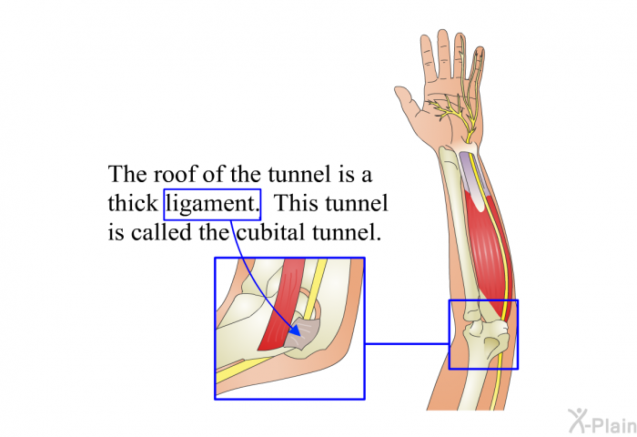 The roof of the tunnel is a thick ligament. This tunnel is called the cubital tunnel.