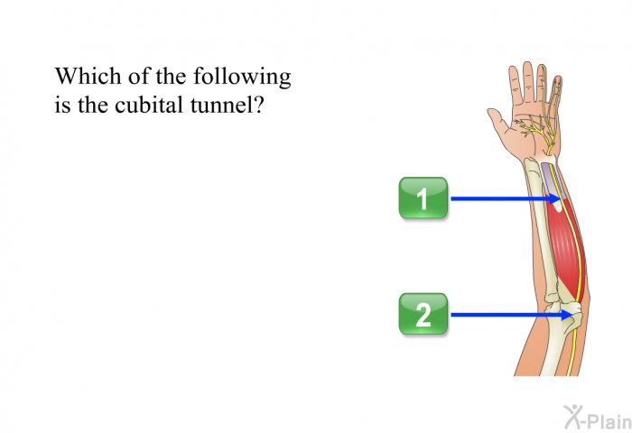 Which of the following is the cubital tunnel? Press A or B