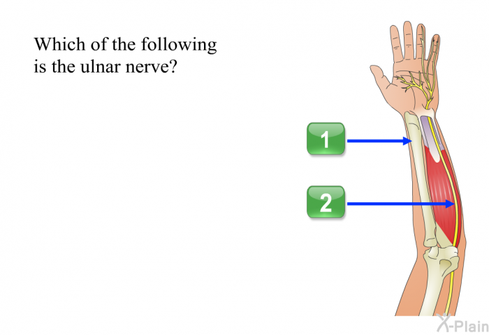 Which of the following is the ulnar nerve? Press A or B