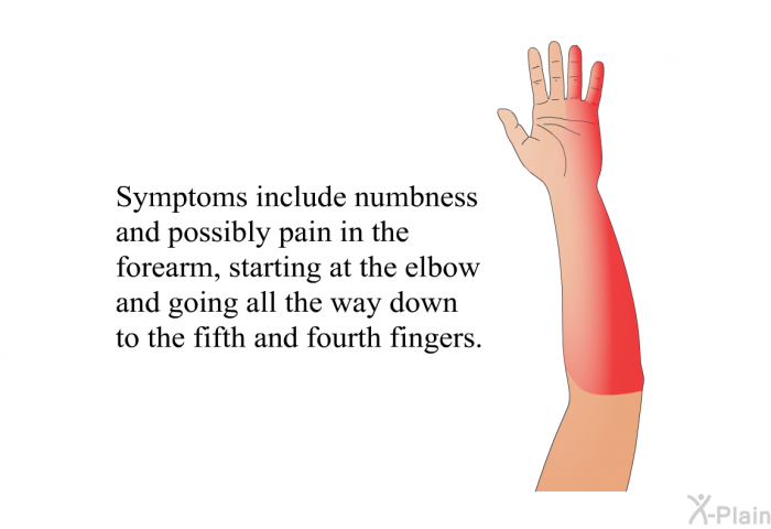 Symptoms include numbness and possibly pain in the forearm, starting at the elbow and going all the way down to the fifth and fourth fingers.