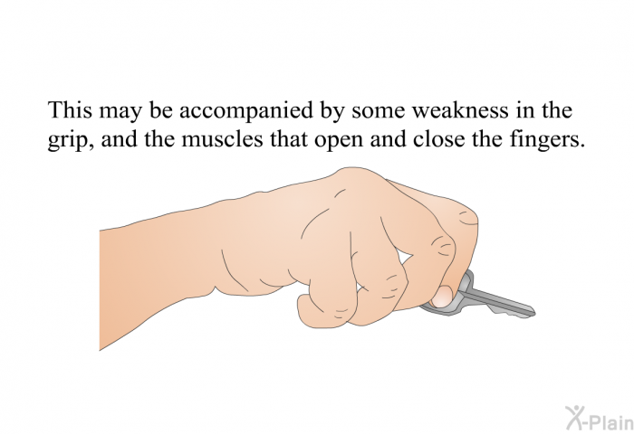 This may be accompanied by some weakness in the grip, and the muscles that open and close the fingers.
