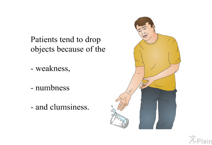 Patients tend to drop objects because of the  weakness, numbness and clumsiness.