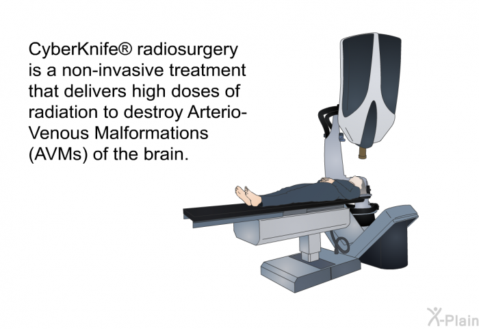 CyberKnife  radiosurgery is a non-invasive treatment that delivers high doses of radiation to destroy Arterio-Venous Malformations (AVMs) of the brain.