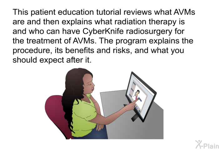 This health information reviews what AVMs are and then explains what radiation therapy is and who can have CyberKnife radiosurgery for the treatment of AVMs. The health information explains the procedure, its benefits and risks, and what you should expect after it.