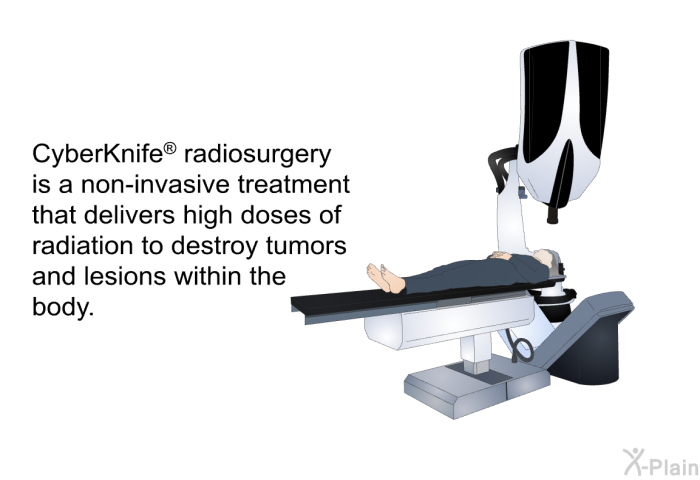 CyberKnife  radiosurgery is a non-invasive treatment that delivers high doses of radiation to destroy tumors and lesions within the body.