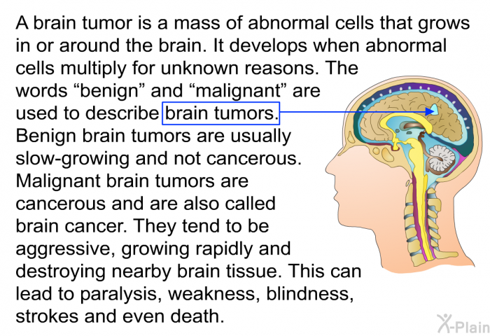 A brain tumor is a mass of abnormal cells that grows in or around the brain. It develops when abnormal cells multiply for unknown reasons. The words ”benign” and “malignant” are used to describe brain tumors. Benign brain tumors are usually slow-growing and not cancerous. Malignant brain tumors are cancerous and are also called brain cancer. They tend to be aggressive, growing rapidly and destroying nearby brain tissue. This can lead to paralysis, weakness, blindness, strokes and even death.