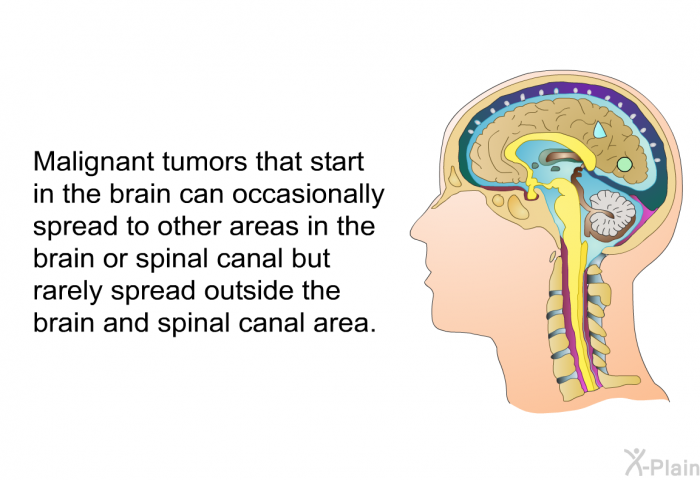 Malignant tumors that start in the brain can occasionally spread to other areas in the brain or spinal canal but rarely spread outside the brain and spinal canal area.