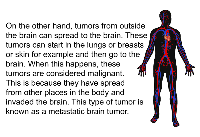On the other hand, tumors from outside the brain can spread to the brain. These tumors can start in the lungs or breasts or skin for example and then go to the brain. When this happens, these tumors are considered malignant. This is because they have spread from other places in the body and invaded the brain. This type of tumor is known as a metastatic brain tumor.
