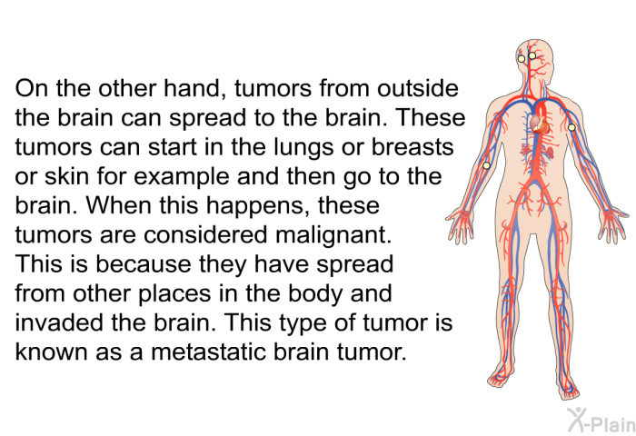On the other hand, tumors from outside the brain can spread to the brain. These tumors can start in the lungs or breasts or skin for example and then go to the brain. When this happens, these tumors are considered malignant. This is because they have spread from other places in the body and invaded the brain. This type of tumor is known as a metastatic brain tumor.