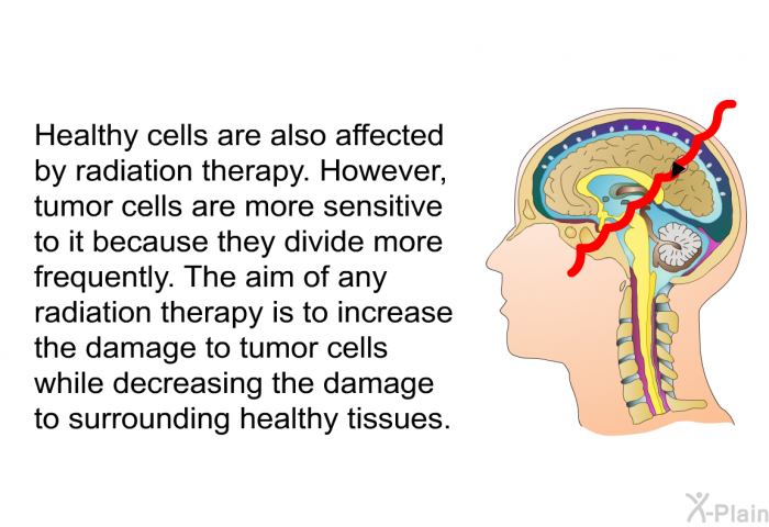 Healthy cells are also affected by radiation therapy. However, tumor cells are more sensitive to it because they divide more frequently. The aim of any radiation therapy is to increase the damage to tumor cells while decreasing the damage to surrounding healthy tissues.