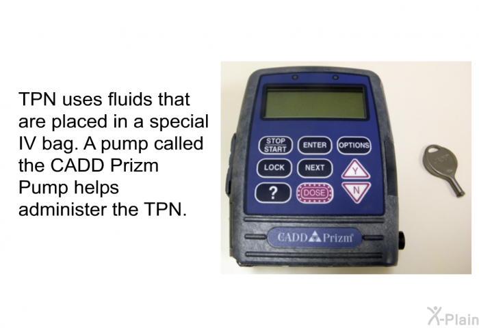 TPN uses fluids that are placed in a special IV bag. A pump called the CADD Prizm Pump helps administer the TPN.
