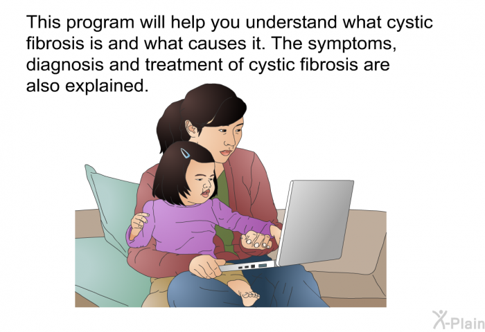 This health information will help you understand what cystic fibrosis is and what causes it. The symptoms, diagnosis and treatment of cystic fibrosis are also explained.