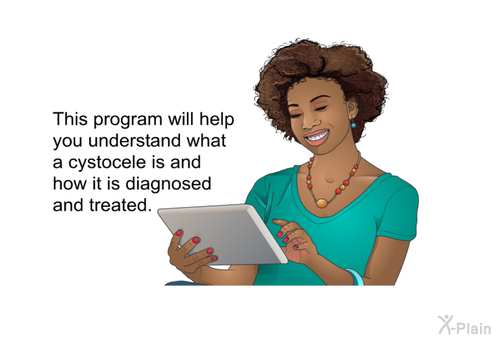 This health information will help you understand what a cystocele is and how it is diagnosed and treated.