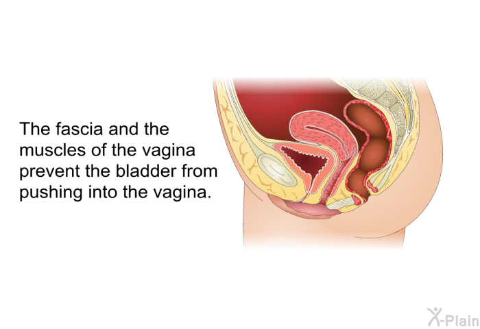 The fascia and the muscles of the vagina prevent the bladder from pushing into the vagina.