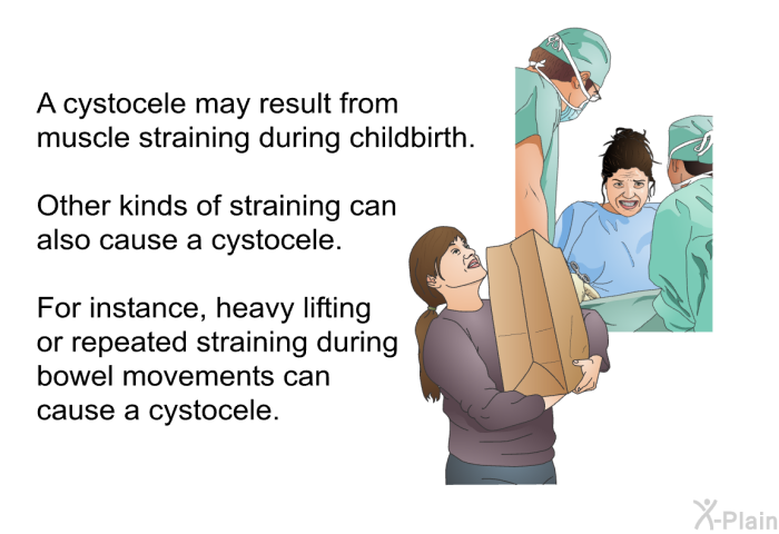 A cystocele may result from muscle straining during childbirth. Other kinds of straining can also cause a cystocele. For instance, heavy lifting or repeated straining during bowel movements can cause a cystocele.