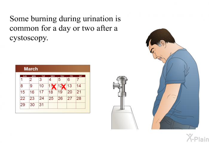 Some burning during urination is common for a day or two after a cystoscopy.