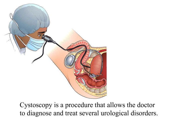 Cystoscopy is a procedure that allows the doctor to diagnose and treat several urological disorders.