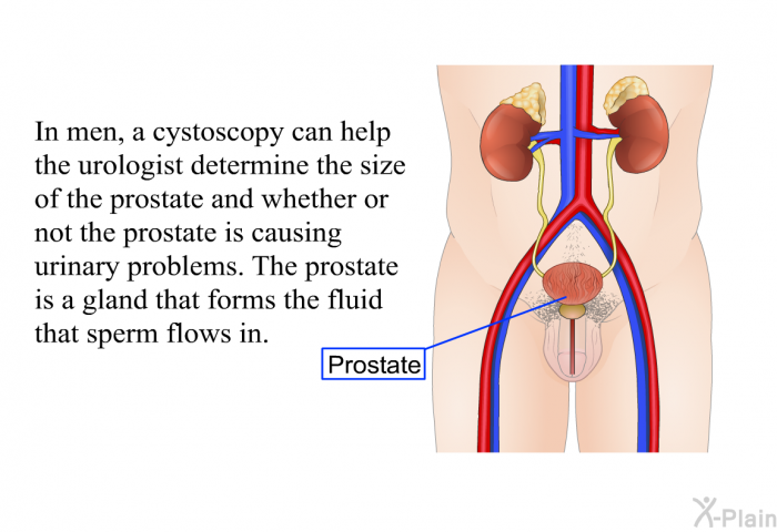 In men, a cystoscopy can help the urologist determine the size of the prostate and whether or not the prostate is causing urinary problems. The prostate is a gland that forms the fluid that sperm flows in.