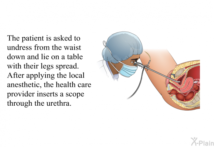 The patient is asked to undress from the waist down and lie on a table with their legs spread. After applying the local anesthetic, the health care provider inserts a scope through the urethra.