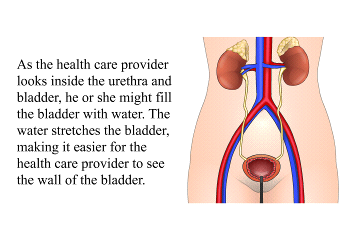 As the health care provider looks inside the urethra and bladder, he or she might fill the bladder with water. The water stretches the bladder, making it easier for the health care provider to see the wall of the bladder.