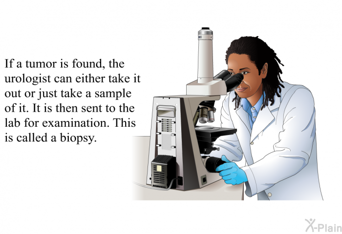 If a tumor is found, the urologist can either take it out or just take a sample of it. It is then sent to the lab for examination. This is called a biopsy.