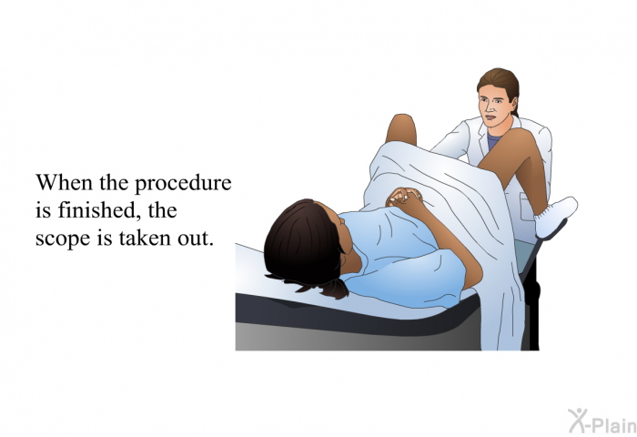 When the procedure is finished, the scope is taken out.