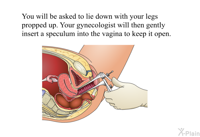 You will be asked to lie down with your legs propped up. Your gynecologist will then gently insert a speculum into the vagina to keep it open.