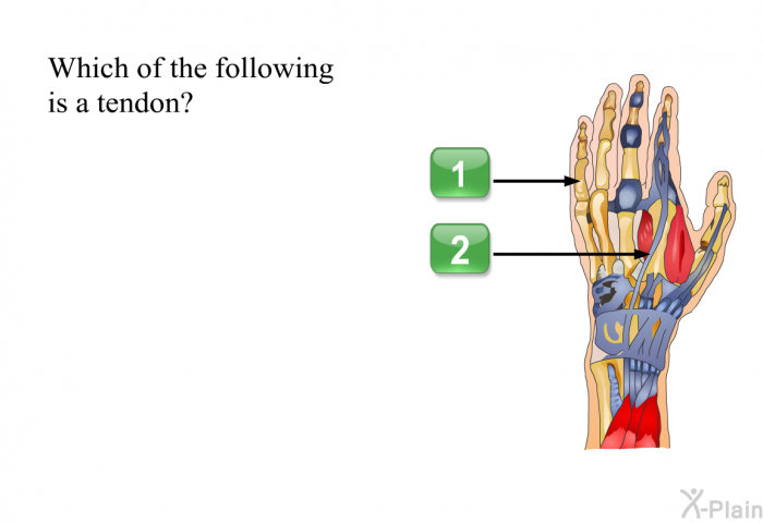 Which of the following is a tendon? Choose one of the following options.