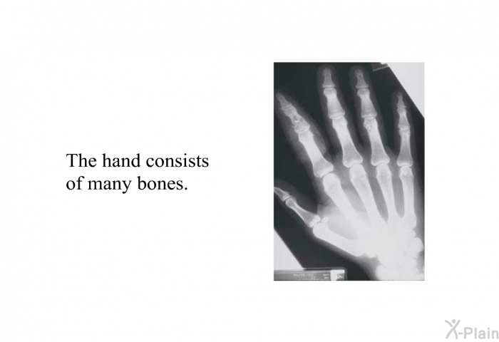 The hand consists of many bones.