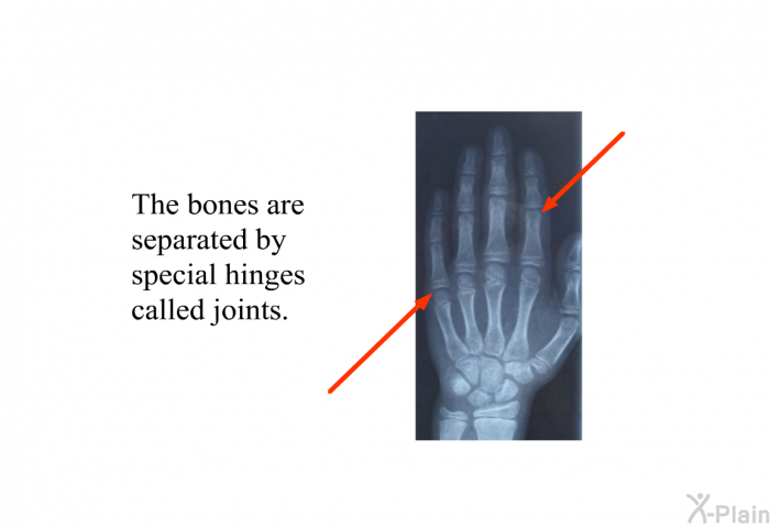 The bones are separated by special hinges called joints.