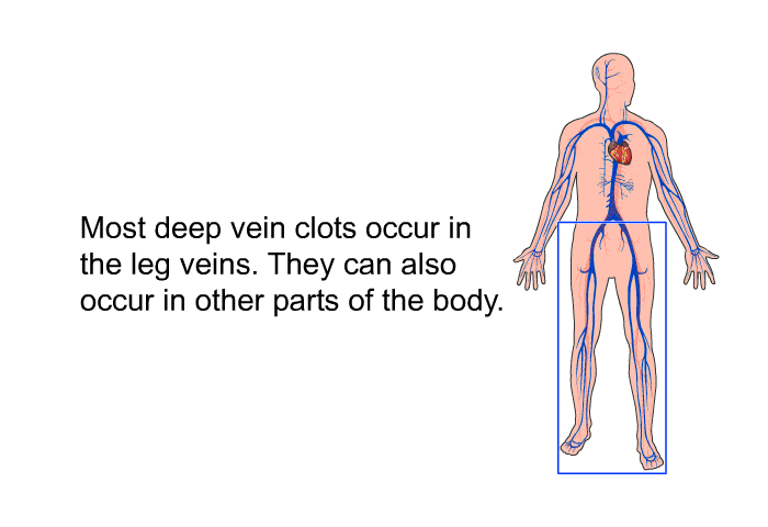 Most deep vein clots occur in the leg veins. They also can occur in other parts of the body.