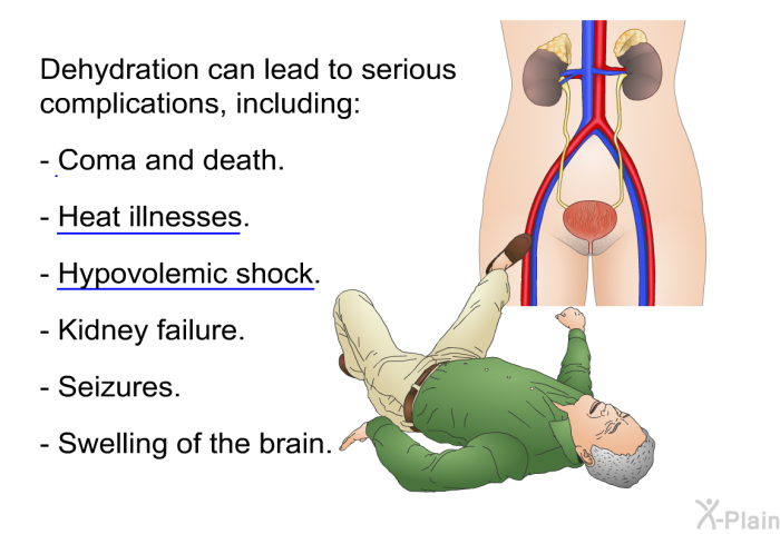 Dehydration can lead to serious complications, including:  Coma and death. Heat illnesses. Hypovolemic shock. Kidney failure. Seizures. Swelling of the brain.