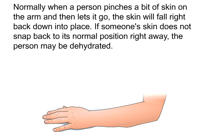 Normally when a person pinches a bit of skin on the arm and then lets it go, the skin will fall right back down into place. If someone's skin does not snap back to its normal position right away, the person may be dehydrated.