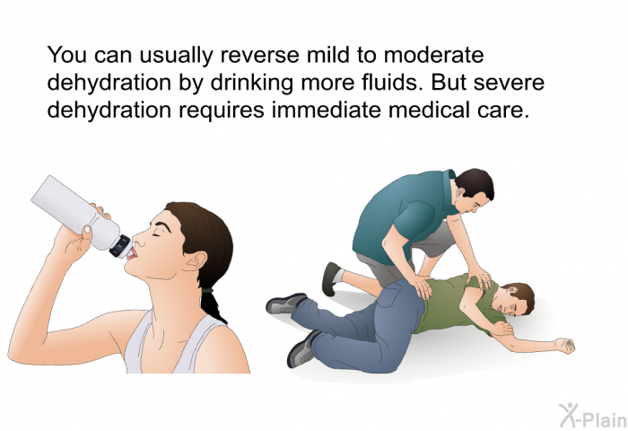 You can usually reverse mild to moderate dehydration by drinking more fluids. But severe dehydration requires immediate medical care.
