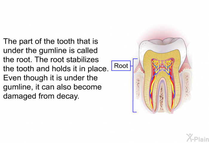 The part of the tooth that is under the gumline is called the root. The root stabilizes the tooth and holds it in place. Even though it is under the gumline, it can also become damaged from decay.