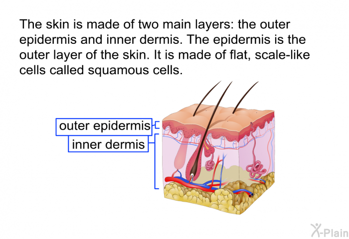 The skin is made of 2 main layers: the outer epidermis and inner dermis. The epidermis is the outer layer of the skin. It is made of flat, scale-like cells called squamous cells.