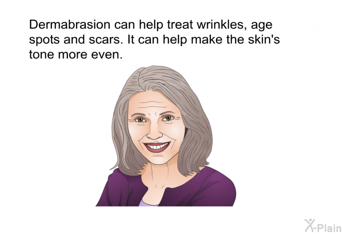 Dermabrasion can help treat wrinkles, age spots and scars. It can help make the skin's tone more even.