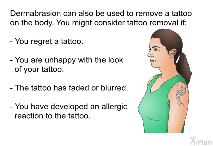 Dermabrasion can also be used to remove a tattoo on the body. You might consider tattoo removal if:  You regret a tattoo. You are unhappy with the look of your tattoo. The tattoo has faded or blurred. You have developed an allergic reaction to the tattoo.