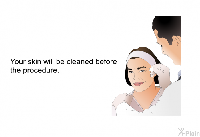 Your skin will be cleaned before the procedure.