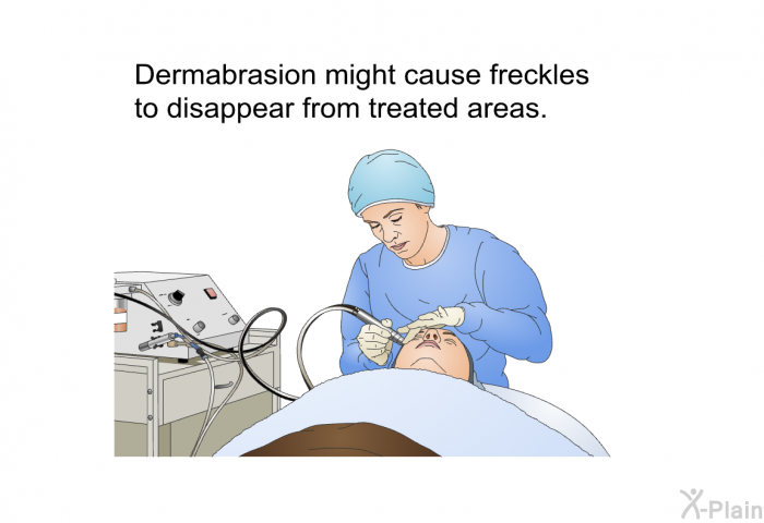 Dermabrasion might cause freckles to disappear from treated areas.