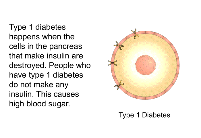 Type 1 diabetes happens when the cells in the pancreas that make insulin are destroyed. People who have type 1 diabetes do not make any insulin. This causes high blood sugar.