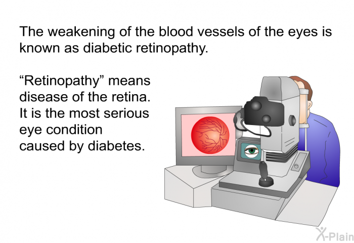 The weakening of the blood vessels of the eyes is known as diabetic retinopathy. Retinopathy means disease of the retina. It is the most serious eye condition caused by diabetes.