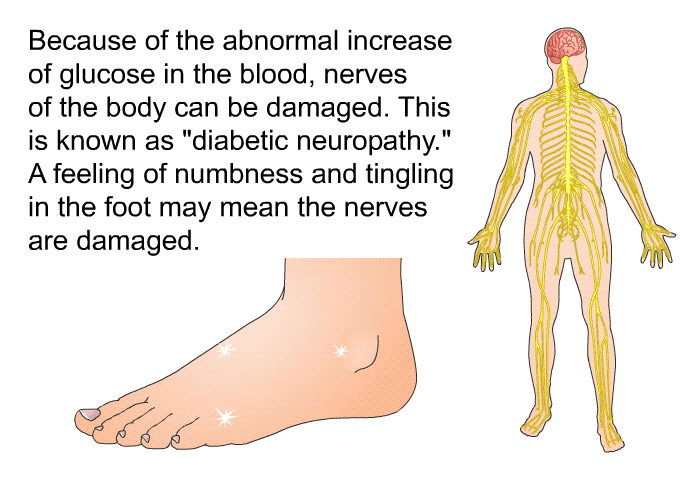 Because of the abnormal increase of glucose in the blood, nerves of the body can be damaged. This is known as “diabetic neuropathy.” A feeling of numbness and tingling in the foot may mean the nerves are damaged.