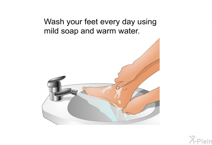 Wash your feet every day using mild soap and warm water.