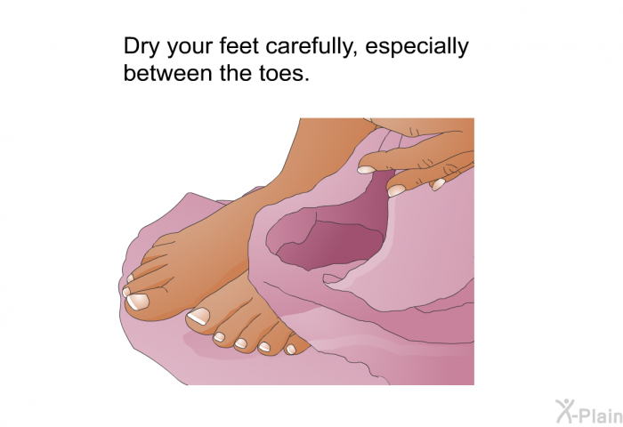 Dry your feet carefully, especially between the toes.