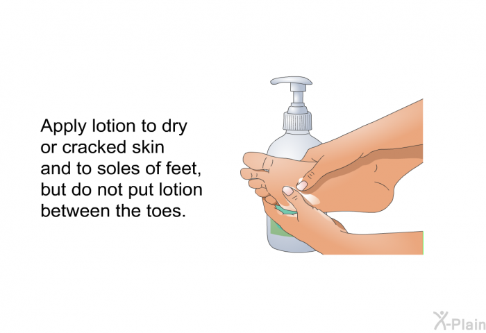Apply lotion to dry or cracked skin and to soles of feet, but do not put lotion between the toes.