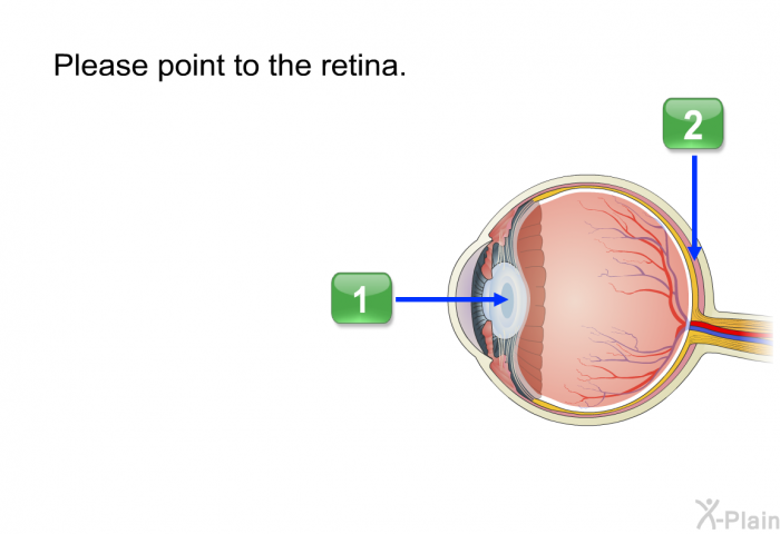 Please point to the retina.