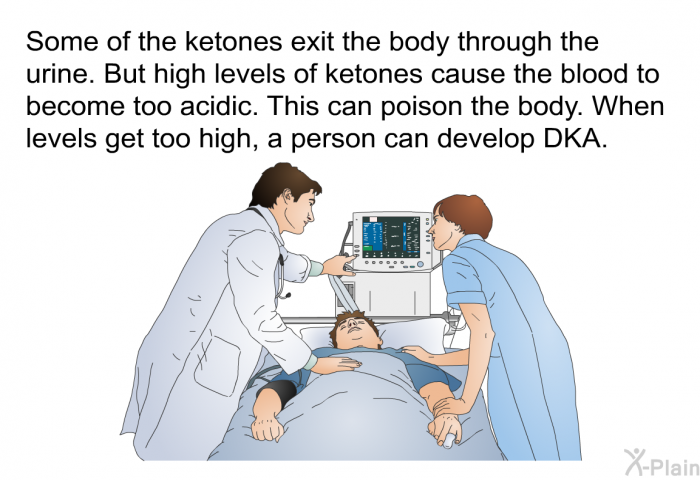 Some of the ketones exit the body through the urine. But high levels of ketones cause the blood to become too acidic. This can poison the body. When levels get too high, a person can develop DKA.