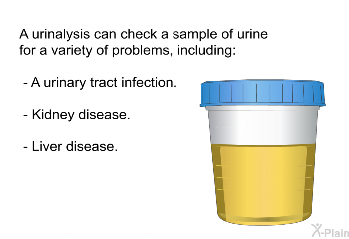 A urinalysis can check a sample of urine for a variety of problems, including:  A urinary tract infection. Kidney disease. Liver disease.