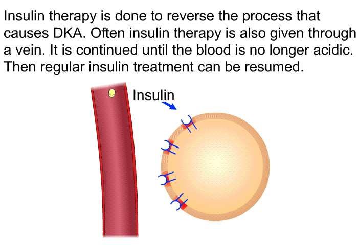 patedu-diabetic-ketoacidosis-dka